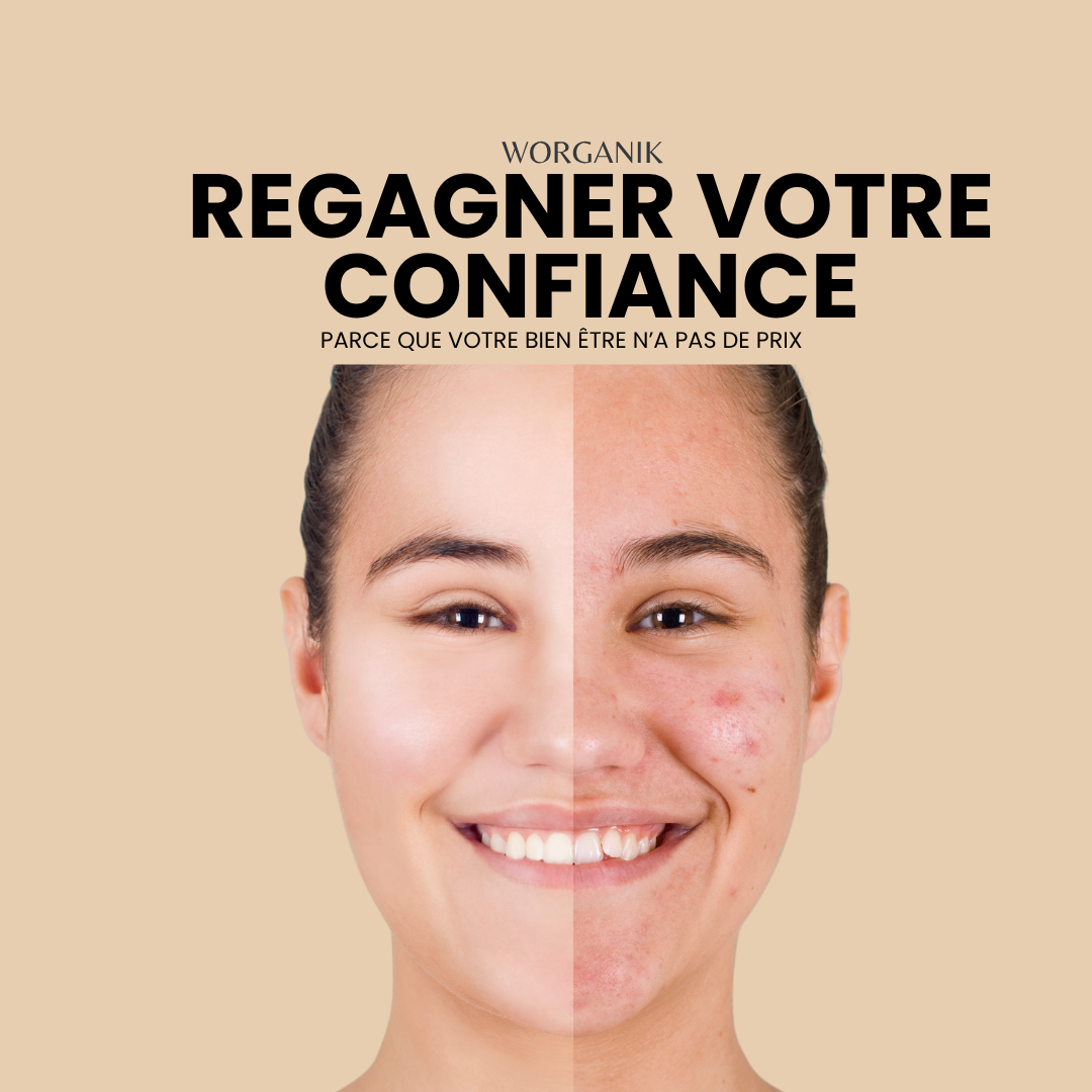 Huile de ricin biologique – 100ml | Pressé à froid et sans hexane
